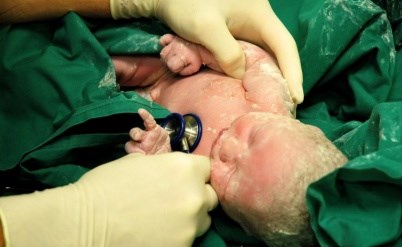 לידת ואקום ולידת מלקחיים- התיתכן רשלנות רפואית?