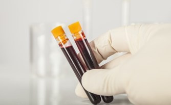פוטר בשל היותו נשא HIV ויפוצה בכ- 50,000 שקלים פוטר בשל היותו נשא HIV ויפוצה בכ- 50,000 שקלים
