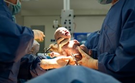 רשלנות רפואית בלידה - שאלות של משפט ומוסר