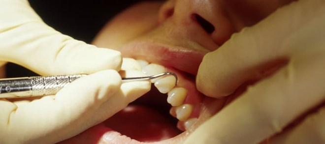 ביצוע טיפול שיניים למטופל
